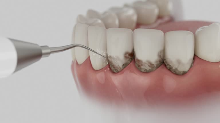Trusted Dental Crowns And Bridges service in Center Line, MI - Dentist Open Now